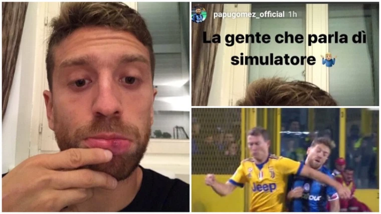 Gomez mostra il labbro gonfio: "La gente che di simulatore"